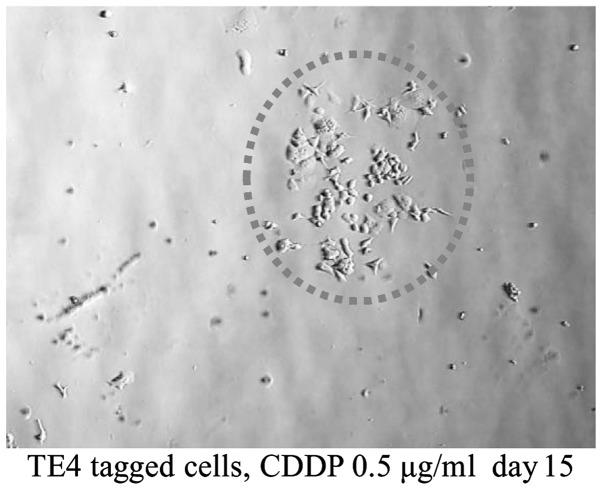 https://cdn.ncbi.nlm.nih.gov/pmc/blobs/a9d6/4532242/b44bade1c892/IJO-47-03-0867-g04.jpg