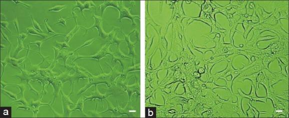 https://cdn.ncbi.nlm.nih.gov/pmc/blobs/a9d9/3901869/891c0654a748/AJA-16-120-g001.jpg