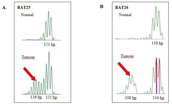 https://cdn.ncbi.nlm.nih.gov/pmc/blobs/a9df/6897031/8681f7dcb1cc/APJCP-20-509-g003.jpg