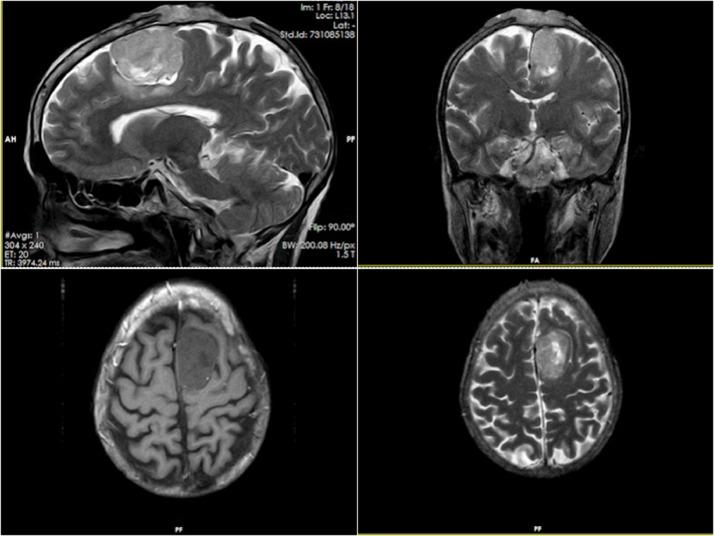 https://cdn.ncbi.nlm.nih.gov/pmc/blobs/a9e0/10491647/7b3fb15ed82c/gr1.jpg