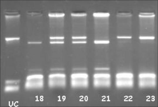 https://cdn.ncbi.nlm.nih.gov/pmc/blobs/a9e0/5582548/df9d0251f822/IJMPO-38-128-g002.jpg
