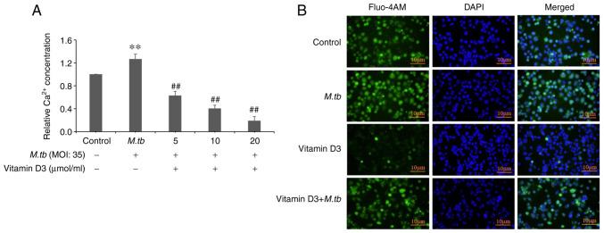 https://cdn.ncbi.nlm.nih.gov/pmc/blobs/a9e1/8815057/6a0cbfa8d58b/etm-23-03-11165-g01.jpg