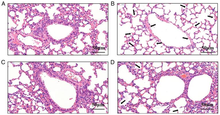 https://cdn.ncbi.nlm.nih.gov/pmc/blobs/a9e1/8815057/a406527f5031/etm-23-03-11165-g03.jpg