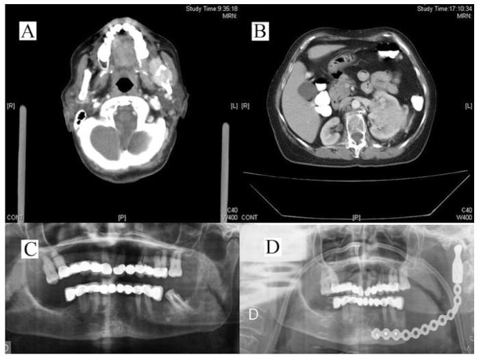 https://cdn.ncbi.nlm.nih.gov/pmc/blobs/a9e2/3448314/e91b44733282/medoral-17-e242-g001.jpg