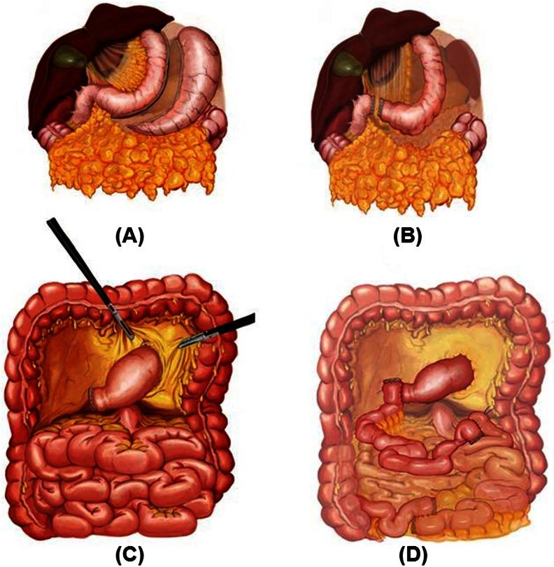 https://cdn.ncbi.nlm.nih.gov/pmc/blobs/a9e5/4460271/69fe7f95caf9/11695_2014_1518_Fig1_HTML.jpg