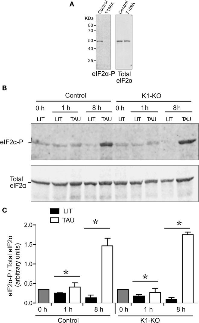 https://cdn.ncbi.nlm.nih.gov/pmc/blobs/a9e8/7176912/7fc10cd08bd9/fcimb-10-00149-g0004.jpg