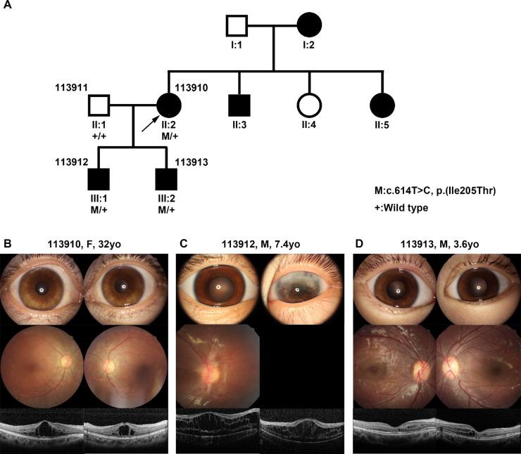 https://cdn.ncbi.nlm.nih.gov/pmc/blobs/a9eb/10528473/c5e76565c379/iovs-64-12-37-f005.jpg