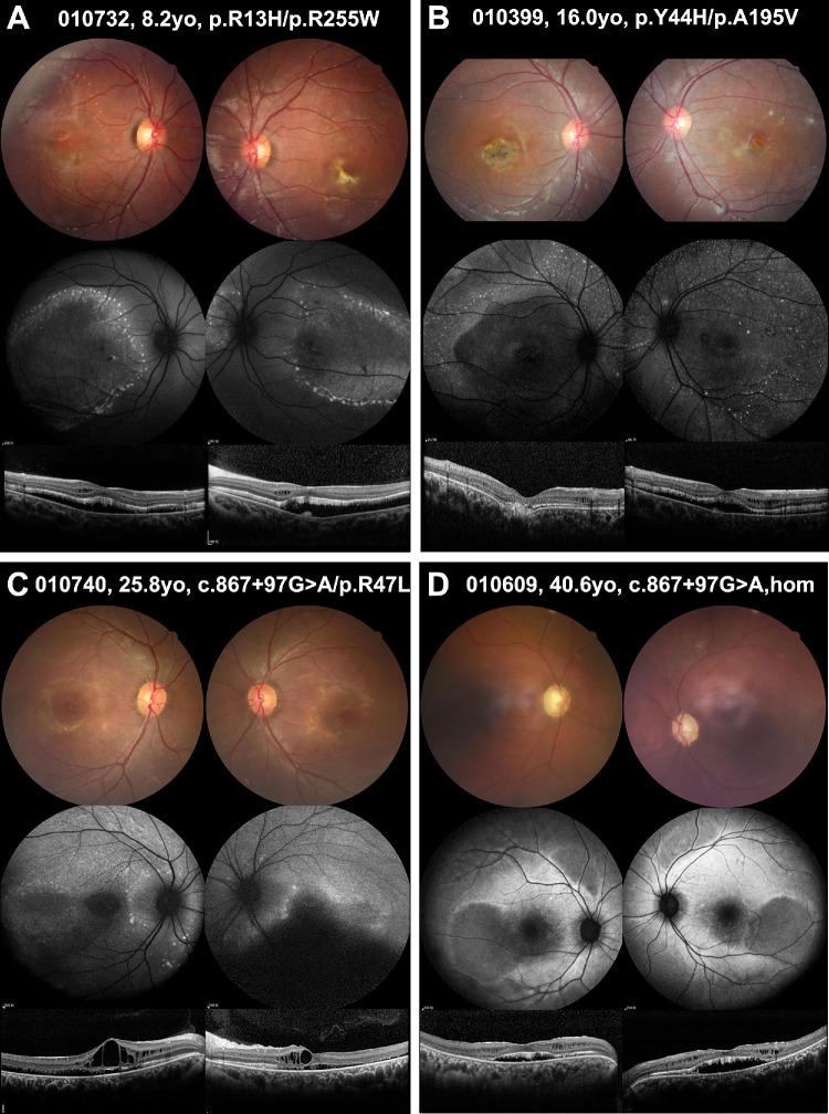 https://cdn.ncbi.nlm.nih.gov/pmc/blobs/a9eb/10528473/d14785914752/iovs-64-12-37-f004.jpg