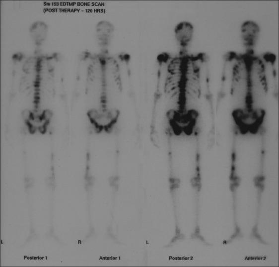 https://cdn.ncbi.nlm.nih.gov/pmc/blobs/a9ed/3543587/130dc2577c0a/IJNM-26-163-g003.jpg