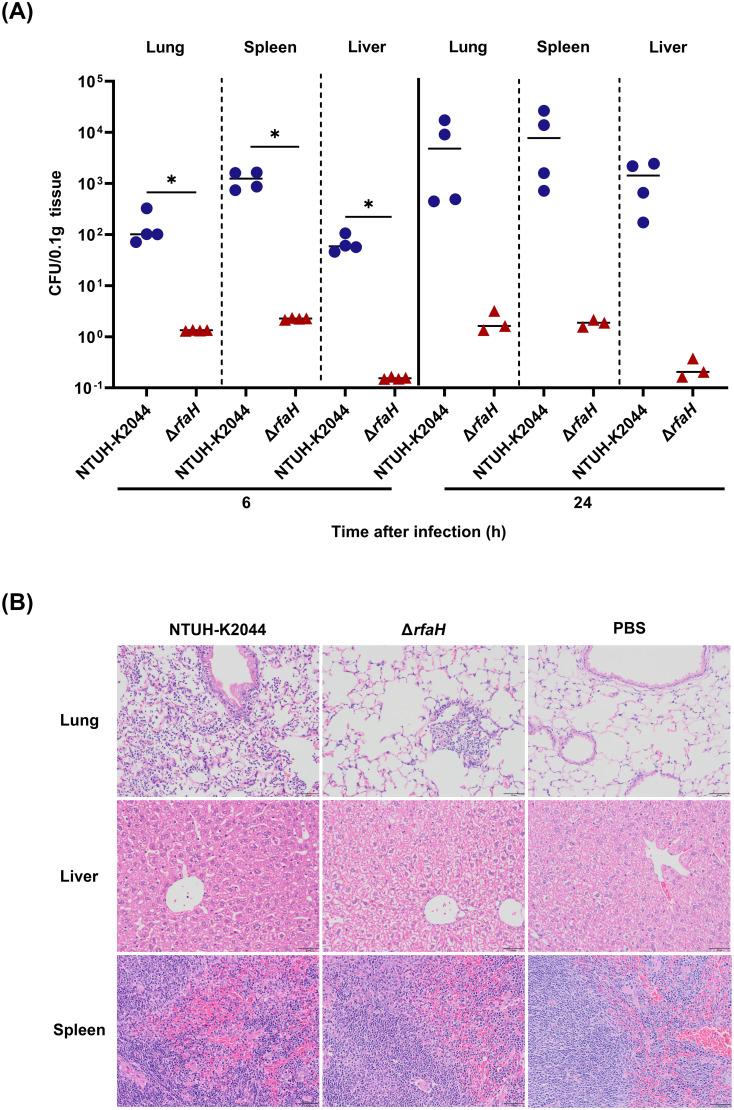 https://cdn.ncbi.nlm.nih.gov/pmc/blobs/a9f2/11448354/b54d1c76c9b1/fcimb-14-1454373-g008.jpg