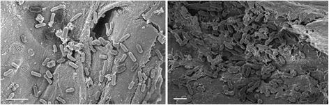 https://cdn.ncbi.nlm.nih.gov/pmc/blobs/a9f6/4385043/dbadf6494915/13568_2015_101_Fig5_HTML.jpg