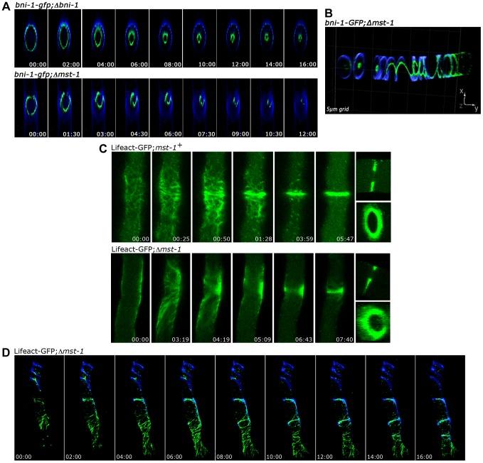 https://cdn.ncbi.nlm.nih.gov/pmc/blobs/a9f9/3998894/8102309f7839/pgen.1004306.g003.jpg