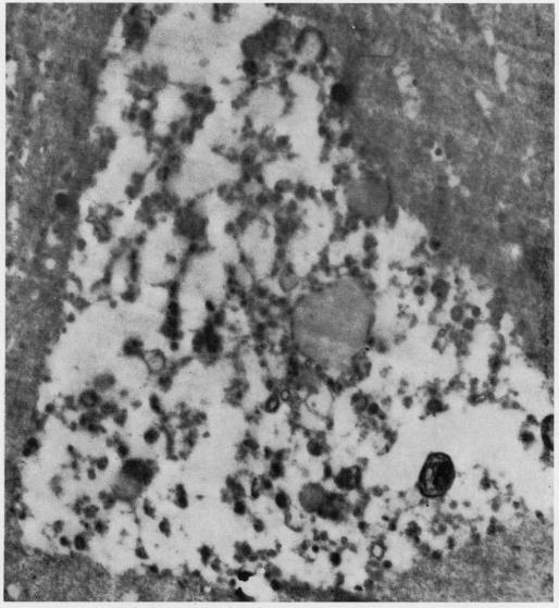 https://cdn.ncbi.nlm.nih.gov/pmc/blobs/a9fc/1010388/0de26e209641/annrheumd00217-0040-a.jpg