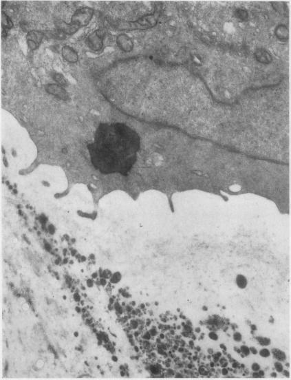 https://cdn.ncbi.nlm.nih.gov/pmc/blobs/a9fc/1010388/ad5c24434b07/annrheumd00217-0039-a.jpg