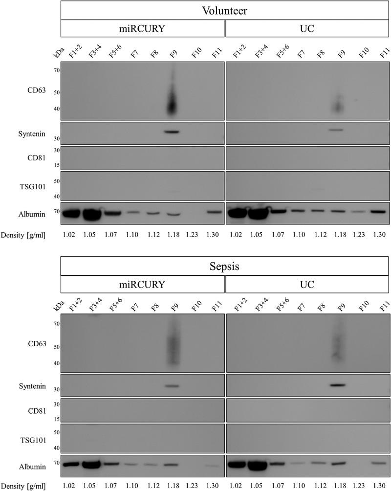 https://cdn.ncbi.nlm.nih.gov/pmc/blobs/aa00/5990937/5ff4a39465e7/ZJEV_A_1481321_F0009_B.jpg