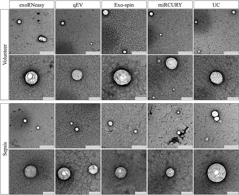 https://cdn.ncbi.nlm.nih.gov/pmc/blobs/aa00/5990937/b697c60bf930/ZJEV_A_1481321_F0007_B.jpg