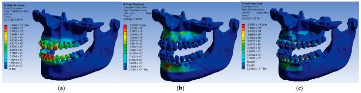 https://cdn.ncbi.nlm.nih.gov/pmc/blobs/aa03/10177595/894e814ad009/diagnostics-13-01567-g026.jpg