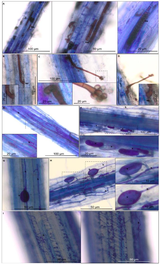 https://cdn.ncbi.nlm.nih.gov/pmc/blobs/aa05/7662716/239dde498c58/ijms-21-07987-g013.jpg