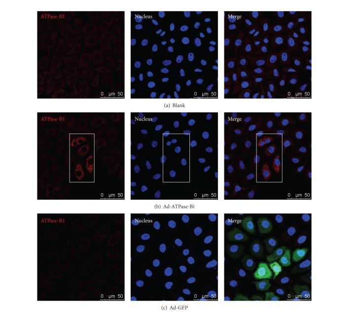 https://cdn.ncbi.nlm.nih.gov/pmc/blobs/aa06/4120797/4502ab21f4a1/IJE2014-356432.002.jpg