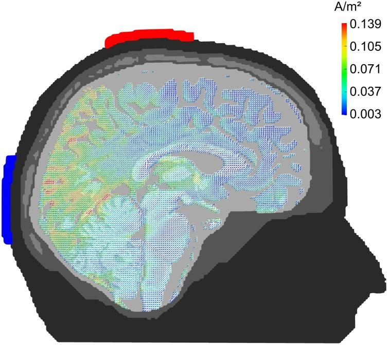 https://cdn.ncbi.nlm.nih.gov/pmc/blobs/aa0a/3639376/89f78c422c65/fnhum-07-00161-g0001.jpg