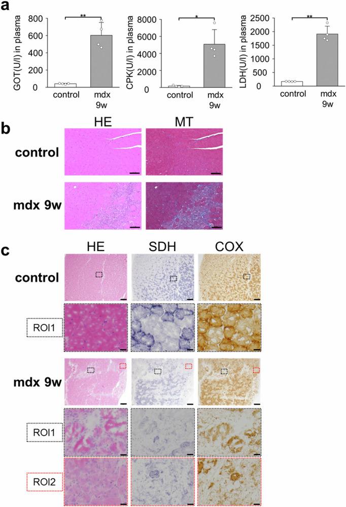 https://cdn.ncbi.nlm.nih.gov/pmc/blobs/aa18/12118763/8efbd6ac2bac/44303_2024_58_Fig3_HTML.jpg