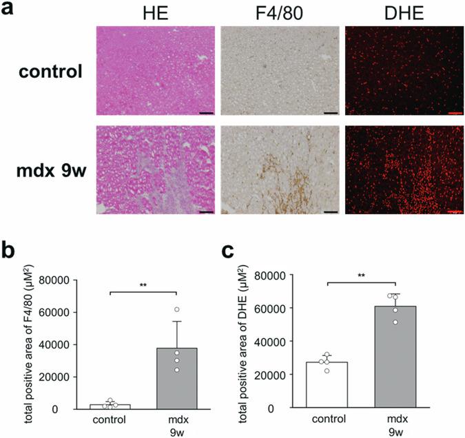 https://cdn.ncbi.nlm.nih.gov/pmc/blobs/aa18/12118763/cc750dc68f18/44303_2024_58_Fig4_HTML.jpg