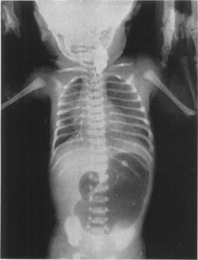 https://cdn.ncbi.nlm.nih.gov/pmc/blobs/aa18/1464996/11953aca988e/annsurg01281-0069-a.jpg