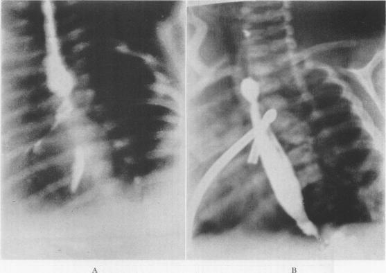 https://cdn.ncbi.nlm.nih.gov/pmc/blobs/aa18/1464996/d8e4c512db38/annsurg01281-0068-a.jpg