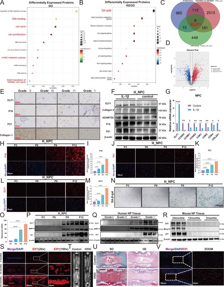https://cdn.ncbi.nlm.nih.gov/pmc/blobs/aa19/12137937/1a90dae054a1/41420_2025_2515_Fig1_HTML.jpg
