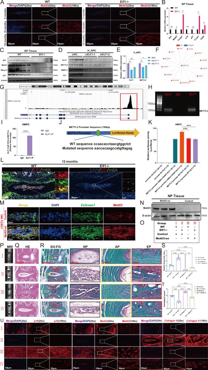 https://cdn.ncbi.nlm.nih.gov/pmc/blobs/aa19/12137937/2009c646c3af/41420_2025_2515_Fig4_HTML.jpg
