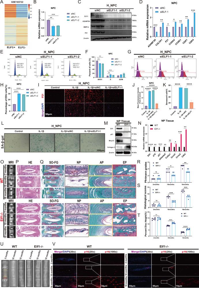 https://cdn.ncbi.nlm.nih.gov/pmc/blobs/aa19/12137937/43f62664c1bf/41420_2025_2515_Fig2_HTML.jpg