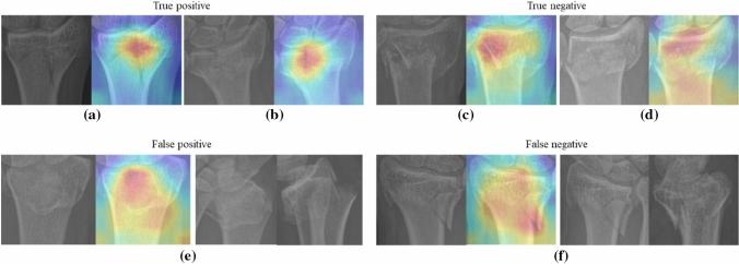 https://cdn.ncbi.nlm.nih.gov/pmc/blobs/aa1d/10209228/3fde0febe91d/13246_2023_1261_Fig7_HTML.jpg