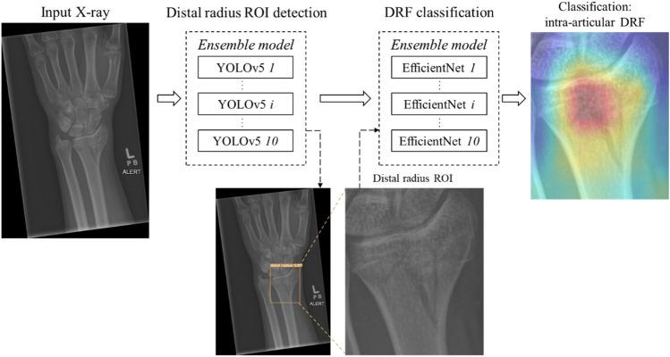 https://cdn.ncbi.nlm.nih.gov/pmc/blobs/aa1d/10209228/fbd23986450c/13246_2023_1261_Fig2_HTML.jpg