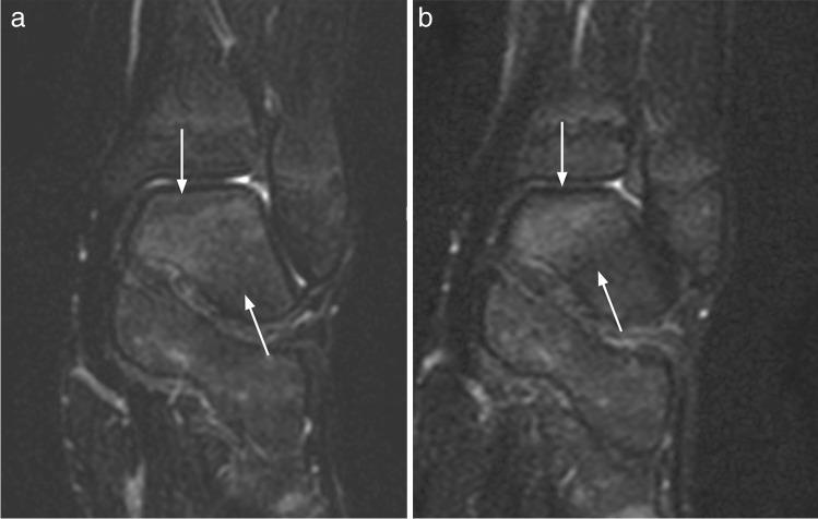 https://cdn.ncbi.nlm.nih.gov/pmc/blobs/aa21/10290001/4d326673de38/330_2023_9413_Fig5_HTML.jpg