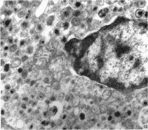 https://cdn.ncbi.nlm.nih.gov/pmc/blobs/aa21/1270796/3b807524140c/janat00415-0112-a.jpg