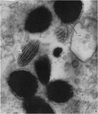 https://cdn.ncbi.nlm.nih.gov/pmc/blobs/aa21/1270796/79914c9dd2cc/janat00415-0111-a.jpg