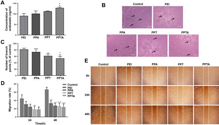 https://cdn.ncbi.nlm.nih.gov/pmc/blobs/aa25/7669533/93216335d65a/IJN-15-8875-g0009.jpg