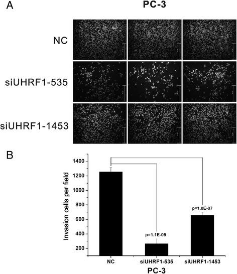 https://cdn.ncbi.nlm.nih.gov/pmc/blobs/aa26/4756440/ae26f0129111/13046_2016_308_Fig5_HTML.jpg