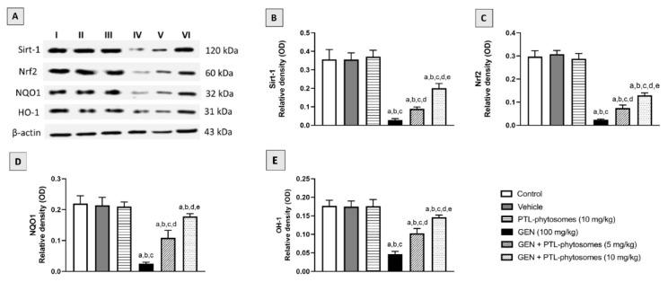 https://cdn.ncbi.nlm.nih.gov/pmc/blobs/aa29/10053629/453d1497167a/molecules-28-02741-g008.jpg