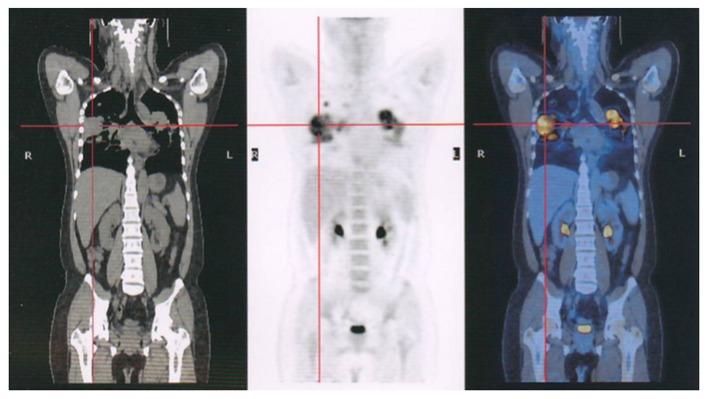 https://cdn.ncbi.nlm.nih.gov/pmc/blobs/aa36/5530223/e91841795289/ol-14-02-1985-g04.jpg