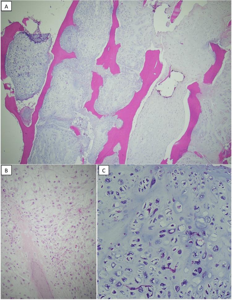 https://cdn.ncbi.nlm.nih.gov/pmc/blobs/aa38/9941032/b0fdd313270f/cureus-0015-00000034057-i02.jpg