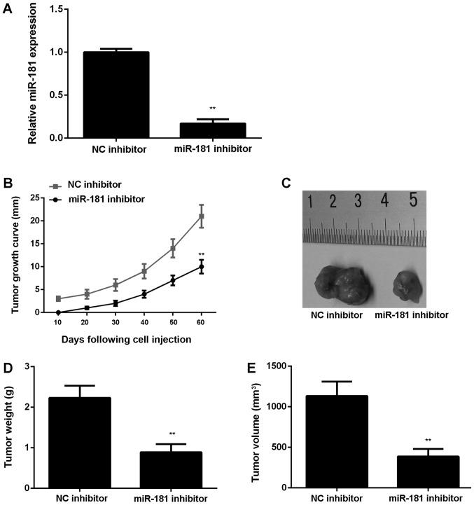 https://cdn.ncbi.nlm.nih.gov/pmc/blobs/aa3d/6236310/987cfda04c9a/MMR-18-06-5603-g03.jpg
