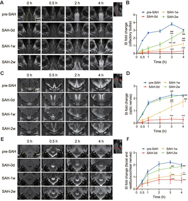 https://cdn.ncbi.nlm.nih.gov/pmc/blobs/aa3f/11426235/5f2347d74127/thnov14p6053g006.jpg