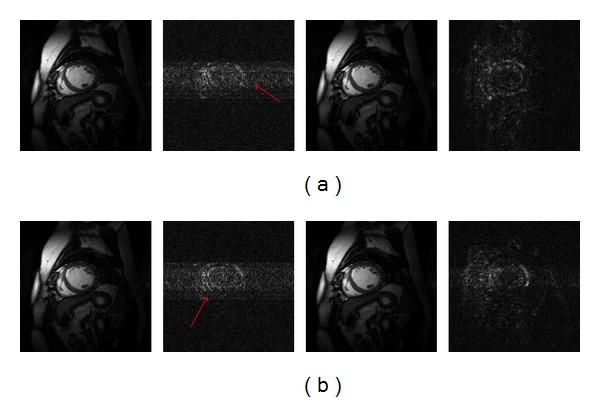 https://cdn.ncbi.nlm.nih.gov/pmc/blobs/aa43/3878744/0789ed826973/CMMM2013-160139.001.jpg