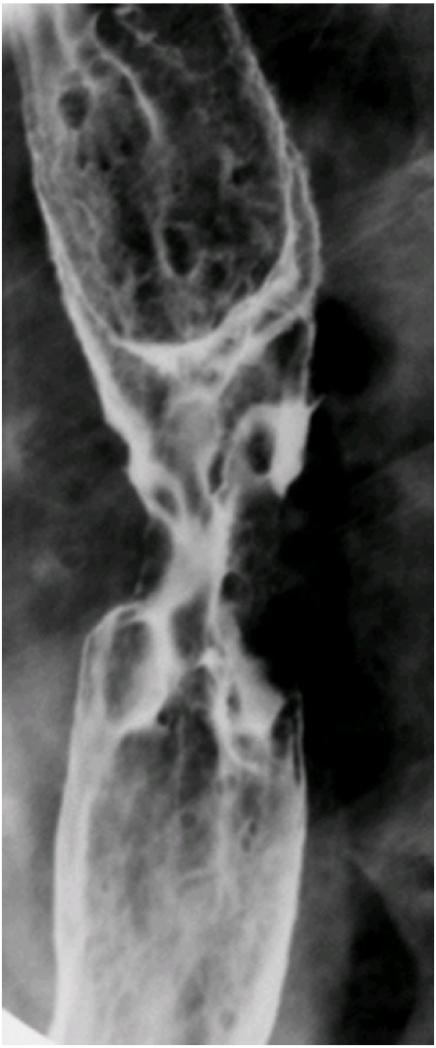 https://cdn.ncbi.nlm.nih.gov/pmc/blobs/aa45/1434596/60192da77f66/ci04012501.jpg