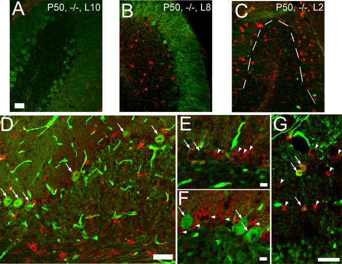 https://cdn.ncbi.nlm.nih.gov/pmc/blobs/aa46/1183526/2aa2f835bdf4/pgen.0010007.g004.jpg