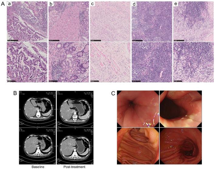 https://cdn.ncbi.nlm.nih.gov/pmc/blobs/aa48/12313684/e79f7547f54c/fimmu-16-1624943-g002.jpg