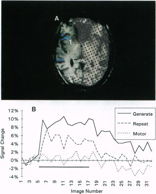 https://cdn.ncbi.nlm.nih.gov/pmc/blobs/aa4b/46631/7a17e6b4456b/pnas01463-0201-a.jpg
