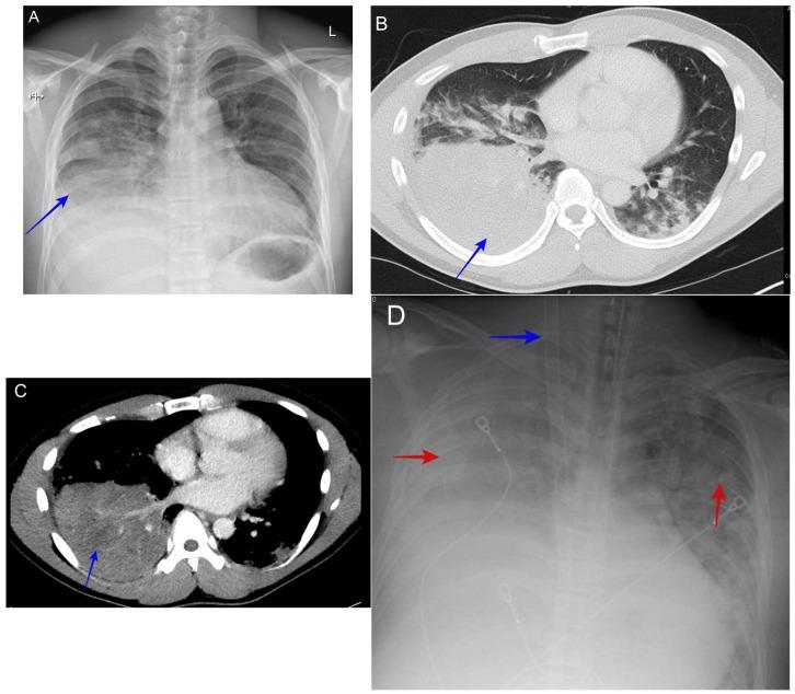 https://cdn.ncbi.nlm.nih.gov/pmc/blobs/aa51/11508864/223767cdc8a1/jof-10-00724-g010.jpg