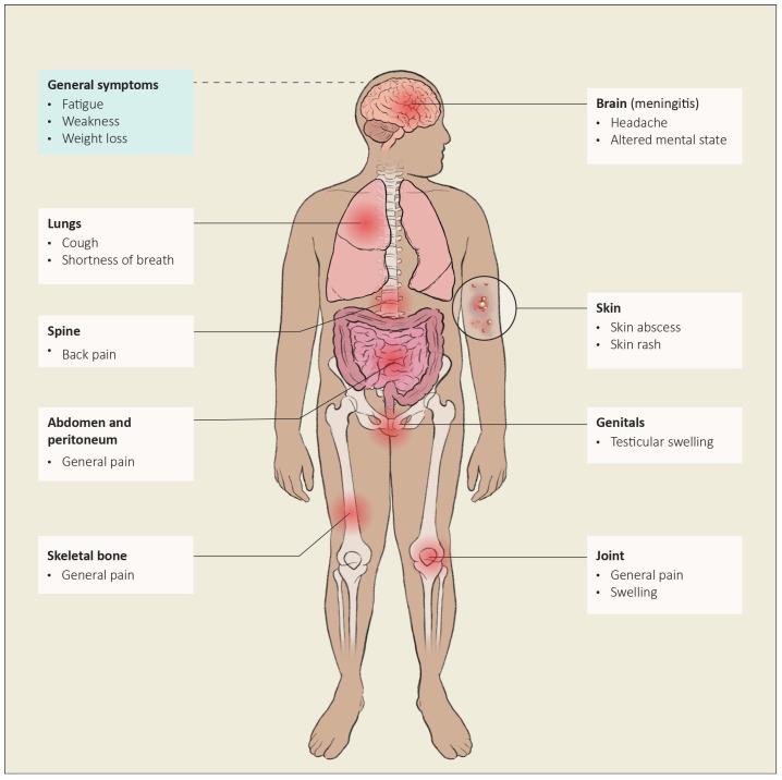 https://cdn.ncbi.nlm.nih.gov/pmc/blobs/aa51/11508864/287a17aaeadc/jof-10-00724-g013.jpg